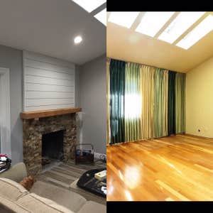 Before and After