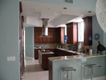 1104 (Before) right view